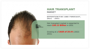 Hair Transplant Market To Reach $30.13 Billion by 2031 with Business Growth, Development Factors and Future Prospects